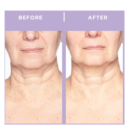Ageless Throat & Decolletage Creme